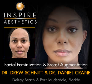 Breast Augmentation and Facial Feminization in Florida